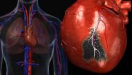 صورة مقال أسباب جلطة القلب