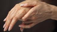 صورة مقال أسباب تنميل اليد اليمنى
