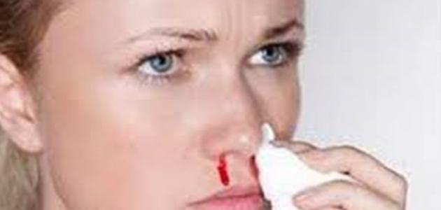 سبب نزول الدم من الأنف صورة مقال سبب نزول الدم من الأنف
