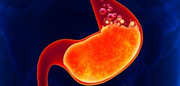 علاج حموضة المعدة صورة مقال علاج حموضة المعدة