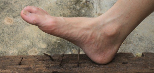 تشخيص مرض الكزاز صورة مقال تشخيص مرض الكزاز