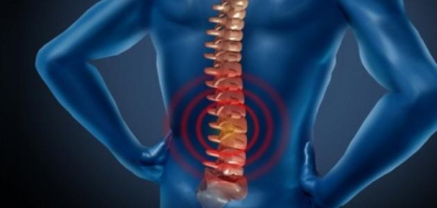 سرطان العمود الفقري صورة مقال سرطان العمود الفقري