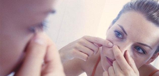 كيف أخفي آثار الحبوب صورة مقال كيف أخفي آثار الحبوب