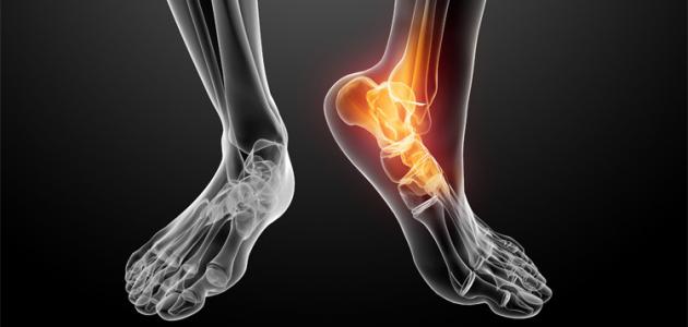 أسباب آلام المفاصل والعظام صورة مقال أسباب آلام المفاصل والعظام