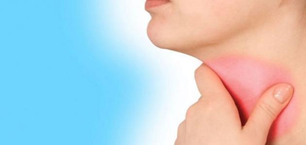 أسباب بحة الصوت المستمرة صورة مقال أسباب بحة الصوت المستمرة