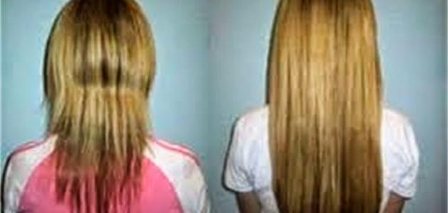 كيف الشعر يطول بسرعة صورة مقال كيف الشعر يطول بسرعة