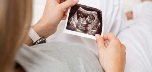 قلة حركة الجنين في الشهر الرابع صورة مقال قلة حركة الجنين في الشهر الرابع