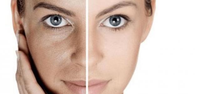 وصفة مجربة لإزالة الكلف من الوجه صورة مقال وصفة مجربة لإزالة الكلف من الوجه