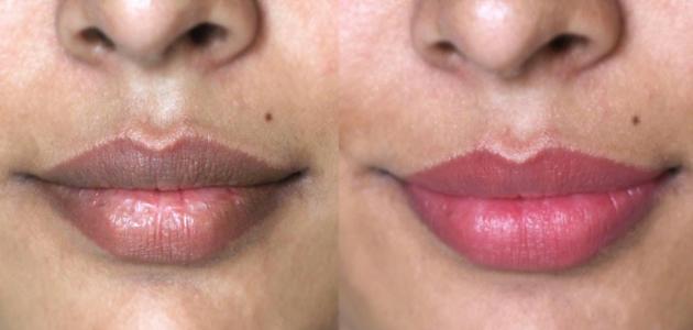 وصفة لإزالة سواد الشفاه صورة مقال وصفة لإزالة سواد الشفاه