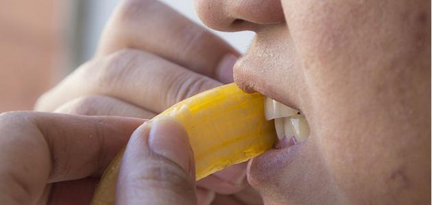 كيفية استخدام قشر الموز لتبييض الأسنان صورة مقال كيفية استخدام قشر الموز لتبييض الأسنان