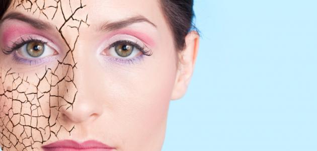 ما سبب جفاف الوجه صورة مقال ما سبب جفاف الوجه