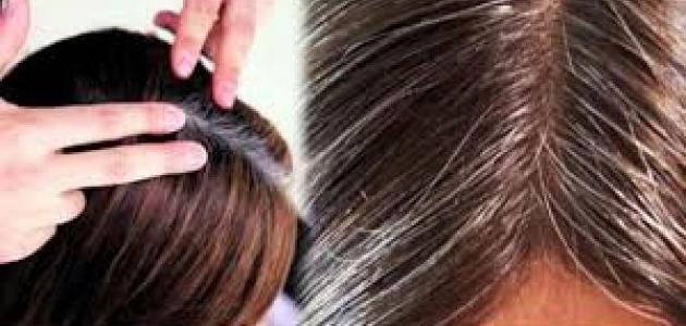 كيف يمكن التخلص من الشعر الأبيض نهائياً صورة مقال كيف يمكن التخلص من الشعر الأبيض نهائياً