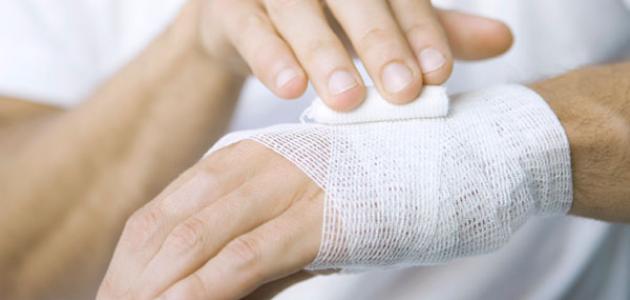 هل العسل يعالج الحروق صورة مقال هل العسل يعالج الحروق