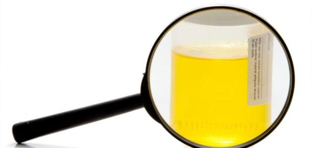 ما علاج التهاب البول صورة مقال ما علاج التهاب البول