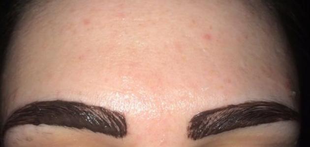 إزالة صبغة الحواجب صورة مقال إزالة صبغة الحواجب