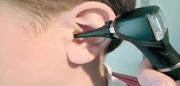 ما هو علاج طنين الأذن المستمر صورة مقال ما هو علاج طنين الأذن المستمر