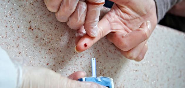 كيفية فحص مرض السكري صورة مقال كيفية فحص مرض السكري