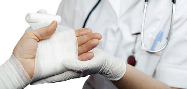 أنواع الحروق وطرق علاجها صورة مقال أنواع الحروق وطرق علاجها