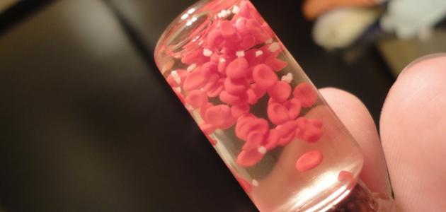 أعراض زيادة الصفائح الدموية صورة مقال أعراض زيادة الصفائح الدموية