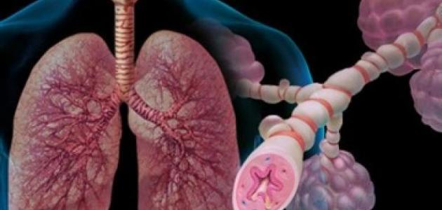 ما هو الربو صورة مقال ما هو الربو