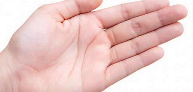 ما سبب خدر اليدين صورة مقال ما سبب خدر اليدين