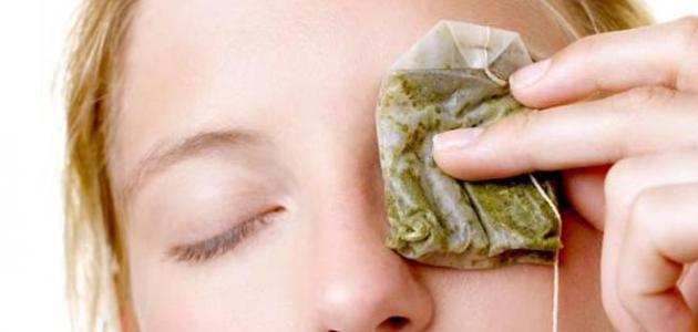 علاج الهالات السوداء تحت العين بطرق طبيعية صورة مقال علاج الهالات السوداء تحت العين بطرق طبيعية