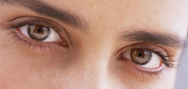 ما هو سبب ظهور الهالات السوداء تحت العين صورة مقال ما هو سبب ظهور الهالات السوداء تحت العين