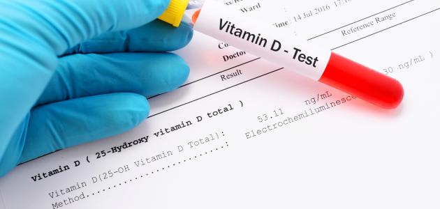 النقص الحاد في فيتامين د صورة مقال النقص الحاد في فيتامين د