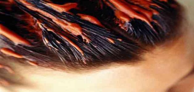 ما هو بلسم الشعر صورة مقال ما هو بلسم الشعر