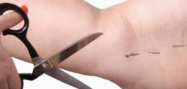 كيفية التخلص من دهون الذراعين صورة مقال كيفية التخلص من دهون الذراعين