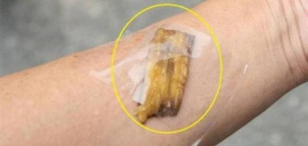 ما فوائد قشر الموز للبشرة صورة مقال ما فوائد قشر الموز للبشرة