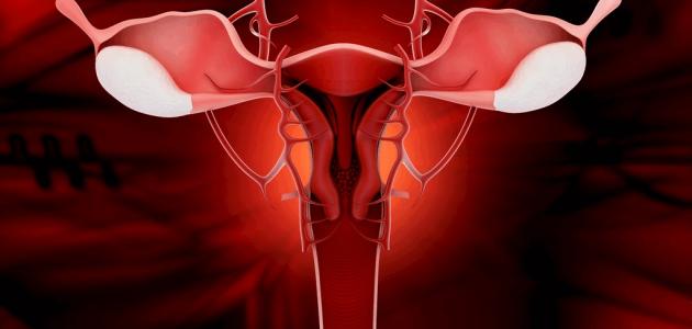 ما هو النزيف الرحمي صورة مقال ما هو النزيف الرحمي