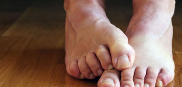 أعراض نقص الصوديوم والبوتاسيوم في الجسم صورة مقال أعراض نقص الصوديوم والبوتاسيوم في الجسم