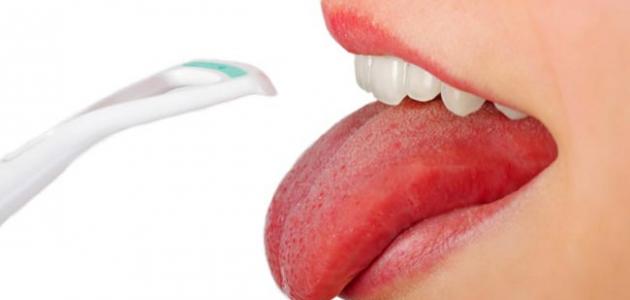 أسباب ظهور فطريات على اللسان صورة مقال أسباب ظهور فطريات على اللسان