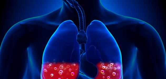 ما هو قصور القلب صورة مقال ما هو قصور القلب