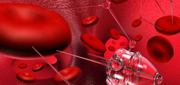 مراحل الإصابة سرطان الدم صورة مقال مراحل الإصابة سرطان الدم