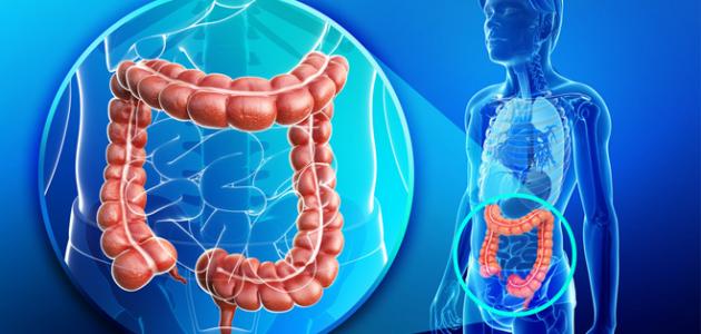 علاج التهاب القولون صورة مقال علاج التهاب القولون