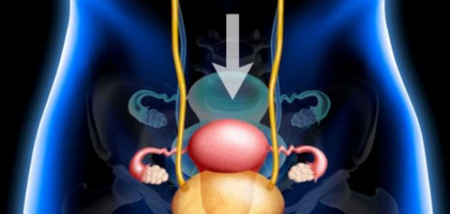 ما هو علاج هبوط الرحم صورة مقال ما هو علاج هبوط الرحم