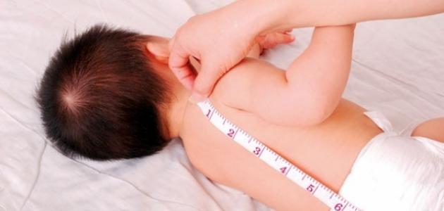 ضعف النمو عند الأطفال الرضع صورة مقال ضعف النمو عند الأطفال الرضع