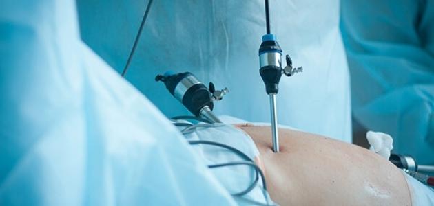 المنظار الرحمي - فيديو صورة مقال المنظار الرحمي - فيديو