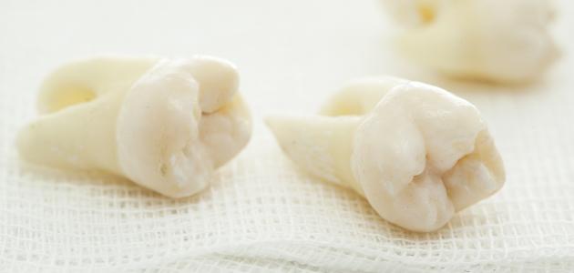 تفسير حلم تساقط الاسنان صورة مقال تفسير حلم تساقط الاسنان