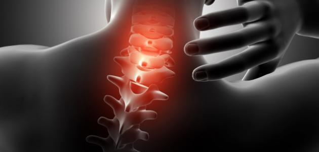 ضغط فقرات الظهر صورة مقال ضغط فقرات الظهر