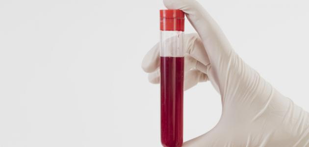 ما هي وظيفة صفائح الدم صورة مقال ما هي وظيفة صفائح الدم