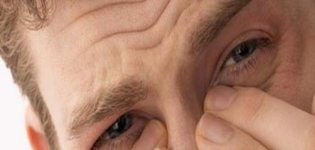 ما هي لحمية الأنف صورة مقال ما هي لحمية الأنف