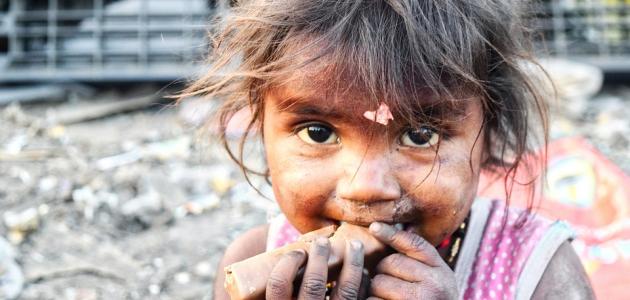 الفرق بين نقص الغذاء وسوء التغذية صورة مقال الفرق بين نقص الغذاء وسوء التغذية