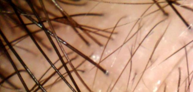 كيفية تقوية بصيلات الشعر صورة مقال كيفية تقوية بصيلات الشعر