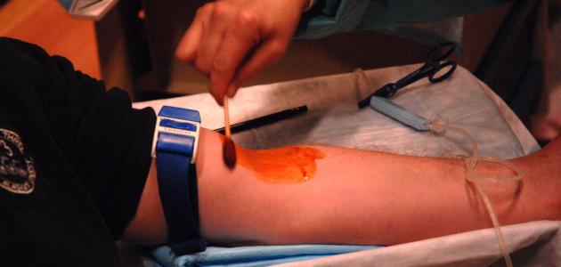 ما هو محلول اليود صورة مقال ما هو محلول اليود