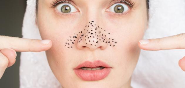 ما هي الرؤوس السوداء صورة مقال ما هي الرؤوس السوداء