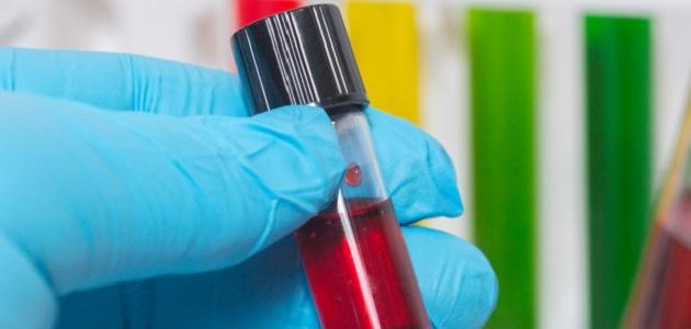 ما هي بلازما الشعر صورة مقال ما هي بلازما الشعر