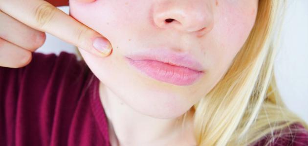 كيف أنحف وجهي صورة مقال كيف أنحف وجهي